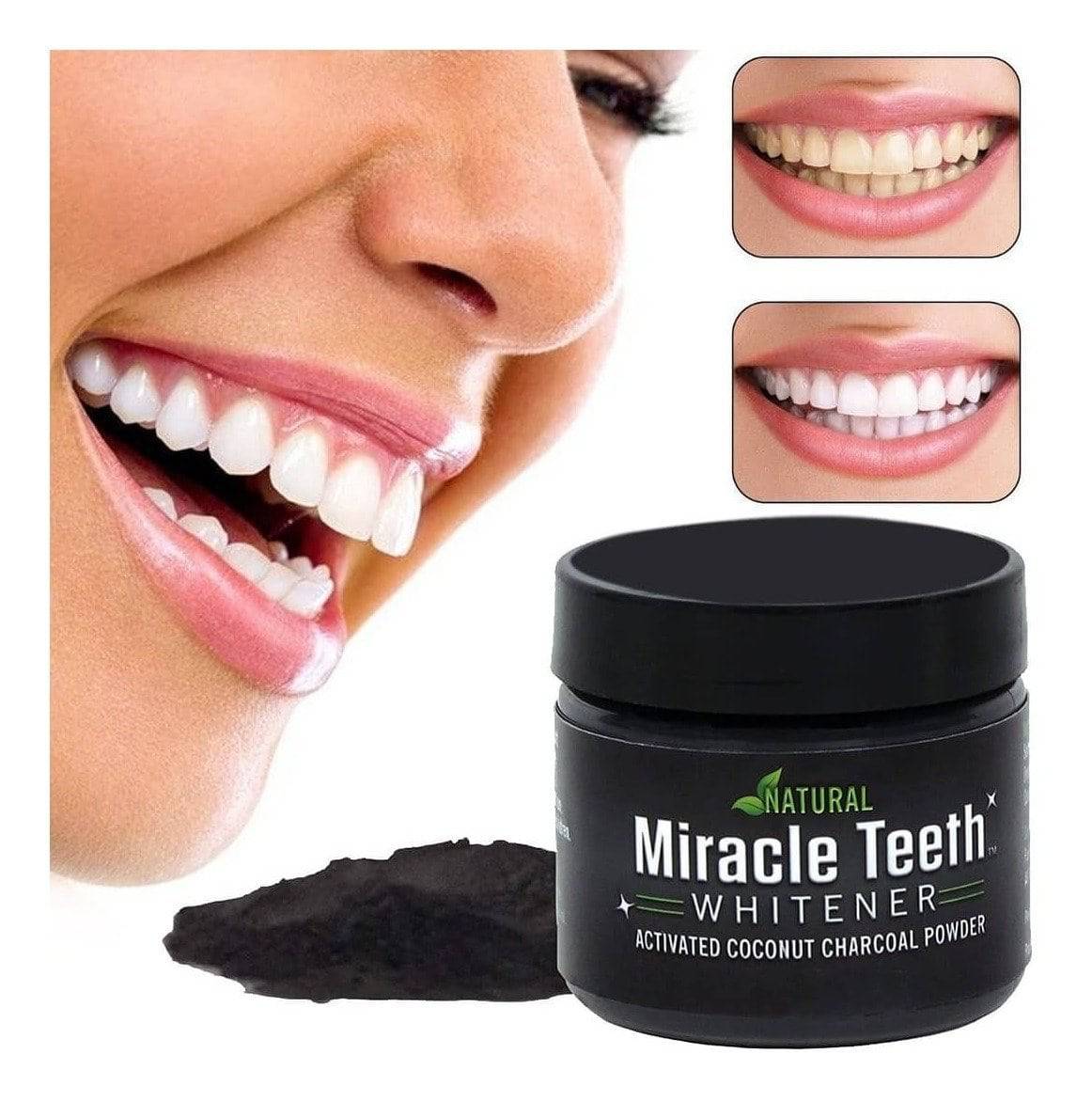 Miracle Teeth Whitener_0